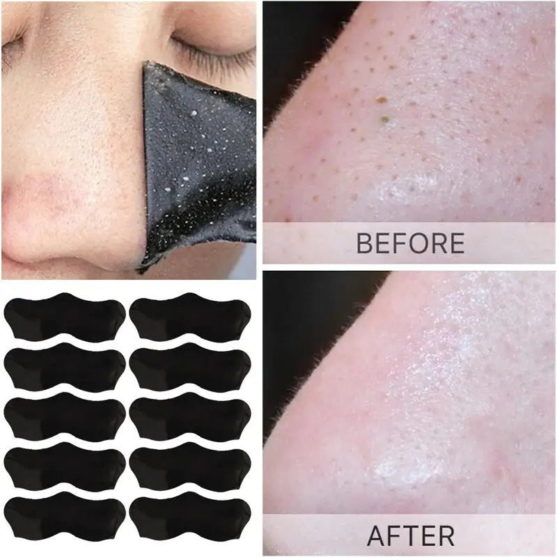 Blackhead Mask Peel Nasal Strips